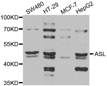 ASL / Argininosuccinate Lyase Antibody
