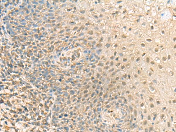 Polyclonal Rabbit anti-Human PPCDC Antibody (IHC)