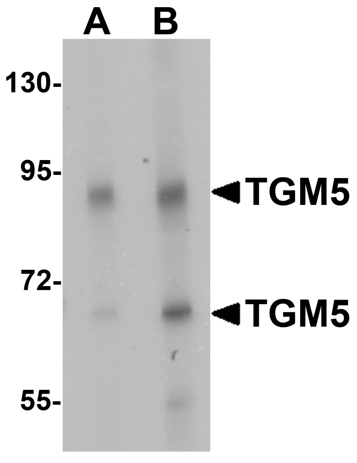 IHC-plus™ TGM5 / Transglutaminase 5 Antibody