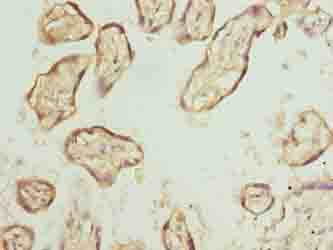 EXOSC1 / CSL4 Antibody