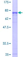 Human CBLC Protein (Recombinant GST)