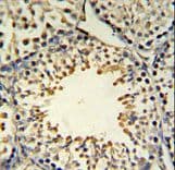 ACSBG2 Antibody (aa237-265)