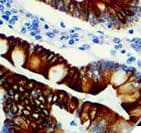 Recombinant Monoclonal Rabbit anti-Human ERBB3 / HER3 Antibody (clone RBT-HER3, Ready-to-Use, IHC)