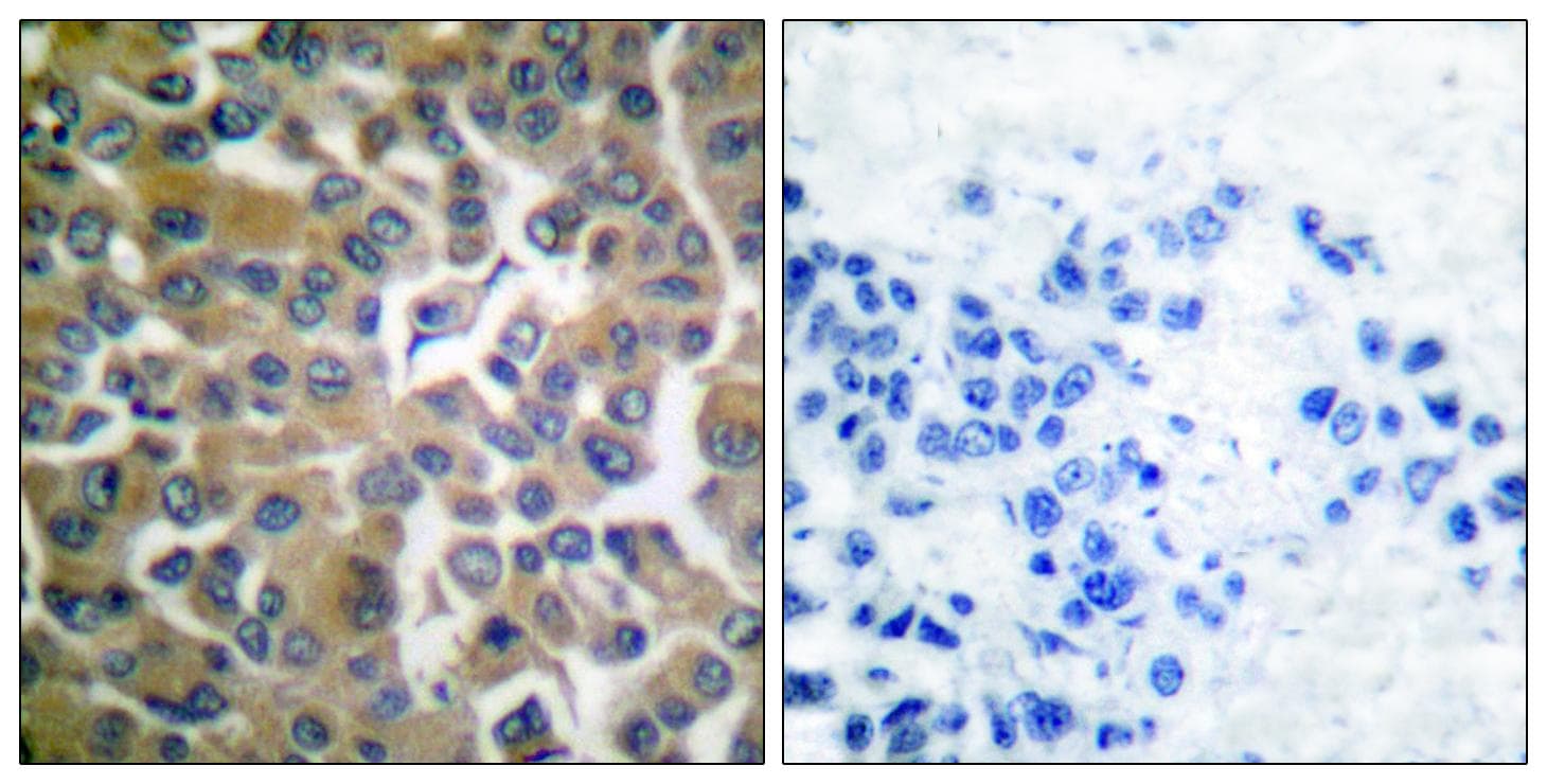 FAP-1 / PTPN13 Antibody