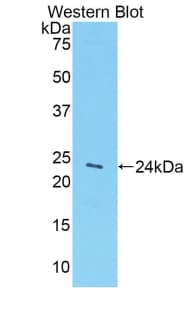 GPC1 / Glypican Antibody (aa343-545)