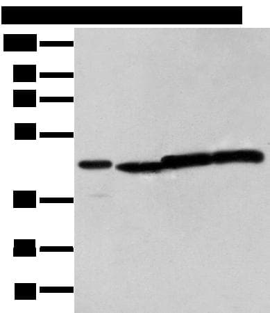 Polyclonal Rabbit anti-Human NUDT12 Antibody (IHC, WB)