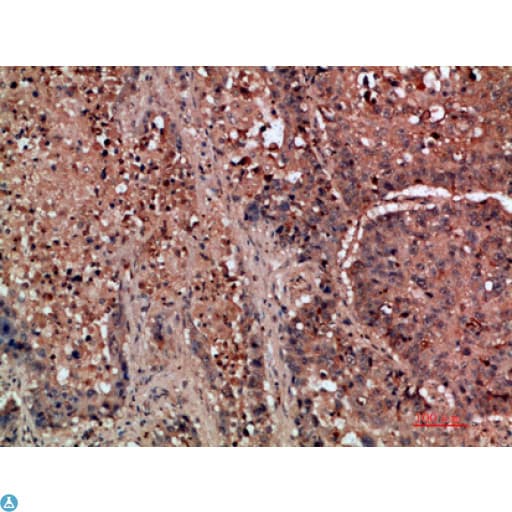 DDR2 Antibody