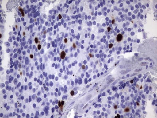 TOP2A / Topoisomerase II Alpha Antibody (aa1100-1531, clone UMAB145, Carrier-free)