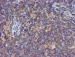 PSMB9 Antibody (clone OTI1G7)