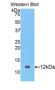 PRAME Antibody (aa416-502, Biotin)