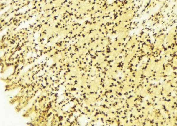Polyclonal Rabbit anti-Human PA26 / SESN1 Antibody (aa138-163, IHC, WB)