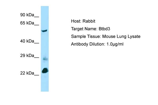 BTBD3 Antibody (aa367-416)
