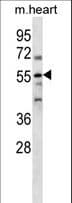 PARP2 Antibody (aa10-40)