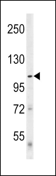 ULK1 Antibody