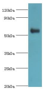PARP3 Antibody (aa294-533)