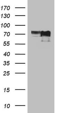 Monoclonal Mouse anti-Human MYCN / N-myc Antibody (clone OTI1F1, Carrier-free, aa229-464, WB)