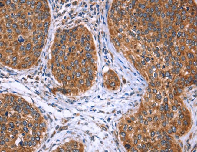 EVC2 Antibody