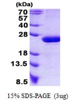 Human RAP2B Protein (Recombinant His)