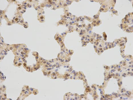 PLCB1 / Phospholipase C Beta 1 Antibody