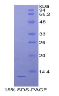 Mouse DBI / ACBD1 Protein (Recombinant His)