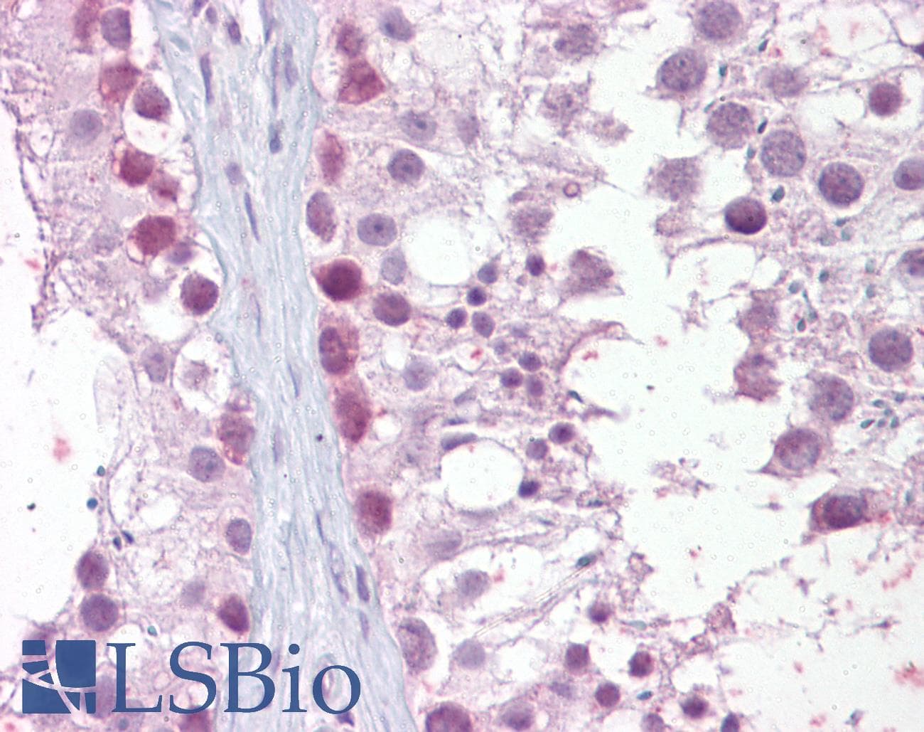 IHC-plus™ MRE11A / MRE11 Antibody