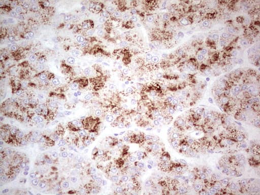 POMK / SGK196 Antibody (aa141-350, clone OTI4D9)