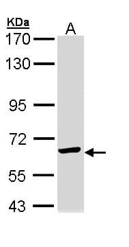 IHC-plus™ Polyclonal Rabbit anti-Human CCT5 / TCP1 Epsilon Antibody (aa89-338, IHC, WB)