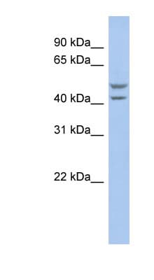 SLC37A4 / G6PT Antibody (aa179-228)
