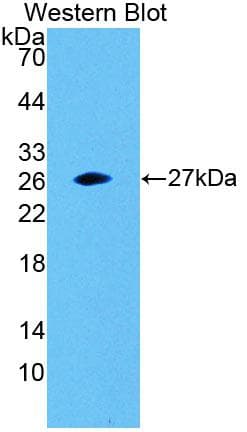 SNAP23 / SNAP-23 Antibody (aa1-211)