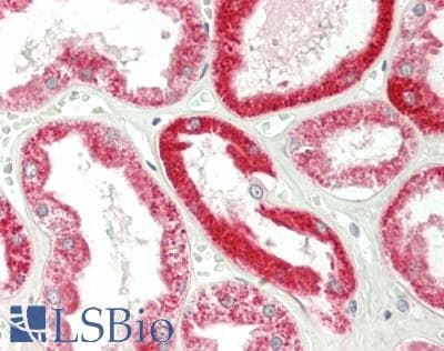 IHC-plus™ ACVR1C / ALK7 Antibody
