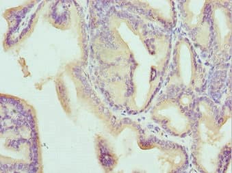 CD1B Antibody