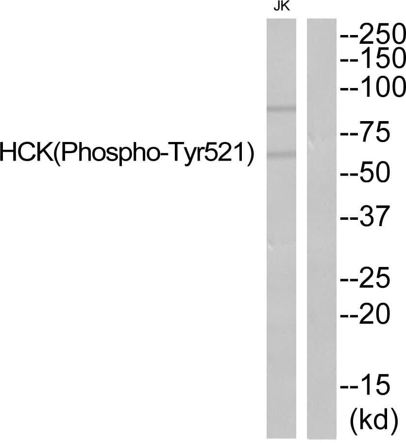 HCK Antibody (phospho-Tyr521)