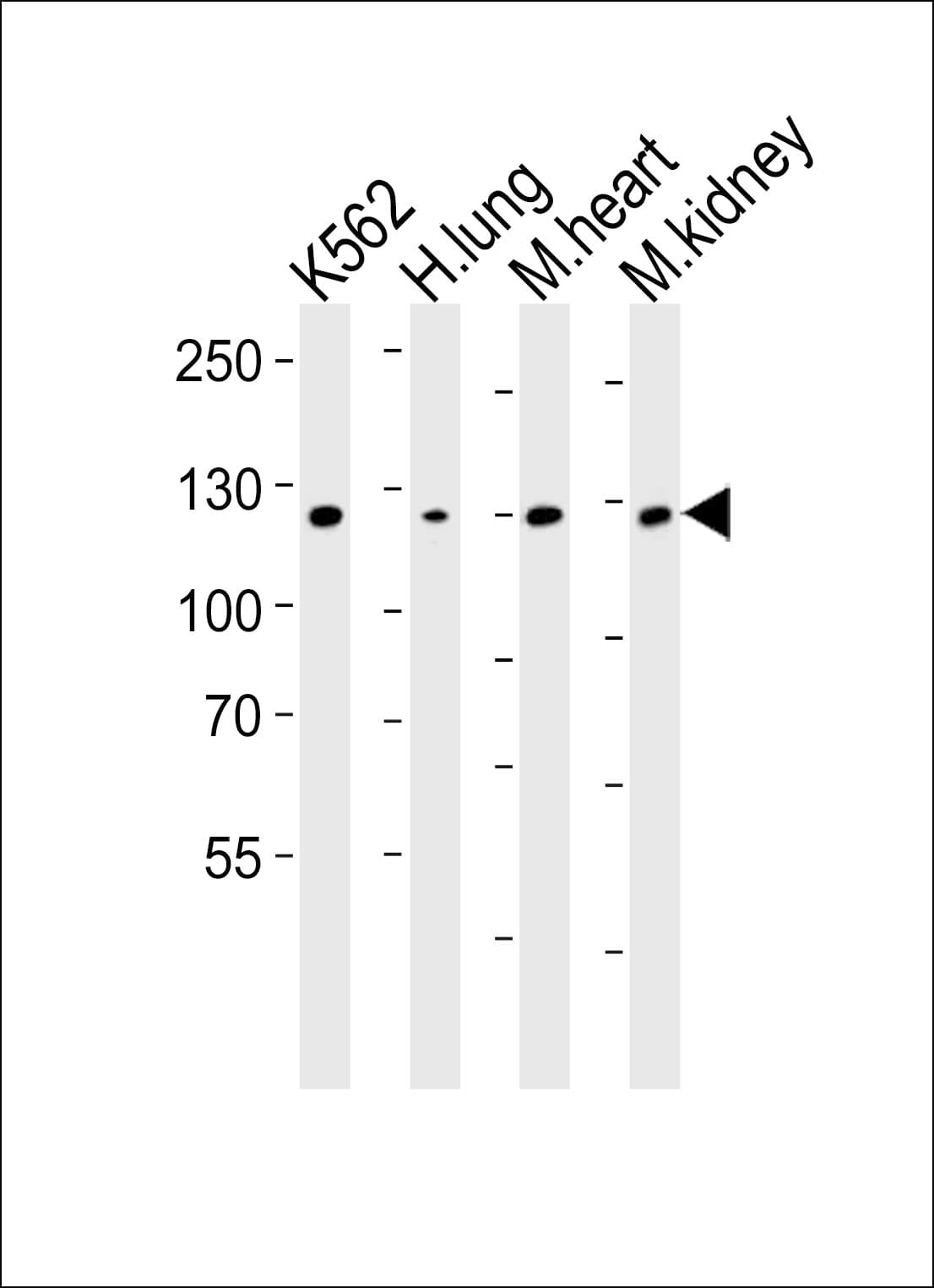 Polyclonal Rabbit anti-Human ROR1 Antibody (IHC, WB)