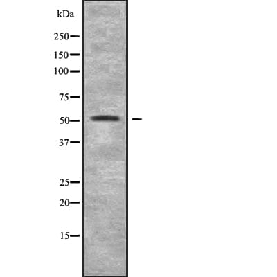 CHRNB3 Antibody