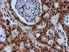 FMR1 / FMRP Antibody (clone OTI3B4)