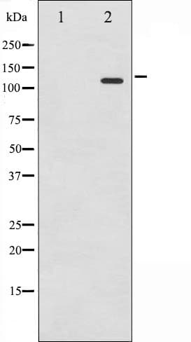 RB1 / Retinoblastoma / RB Antibody (phospho-Ser795)