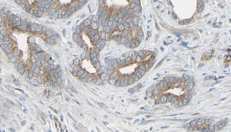 TP / Thymidine Phosphorylase Antibody