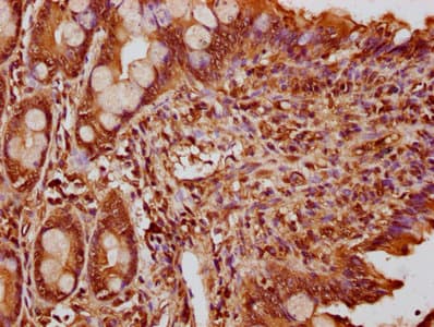 FEV / PET1 Antibody