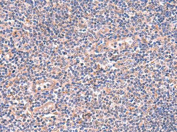 Polyclonal Rabbit anti-Human OSBPL2 Antibody (IHC)