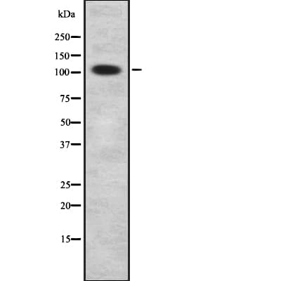Polyclonal Rabbit anti-Human STK9 / CDKL5 Antibody (IHC, WB)