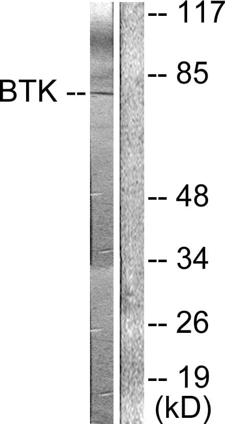 BTK Antibody (aa188-237)