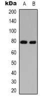 MAPT / Tau Antibody (Acetyl-Lys686)