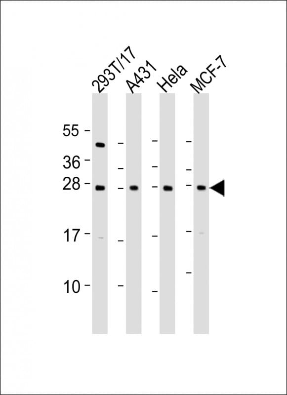 RPL14 / Ribosomal Protein L14 Antibody (aa173-204)