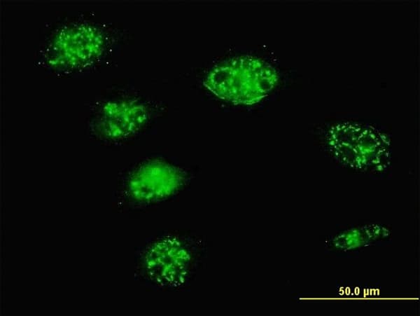 Monoclonal Mouse anti-Human BAF60C / SMARCD3 Antibody (clone 1G6, IF, WB)