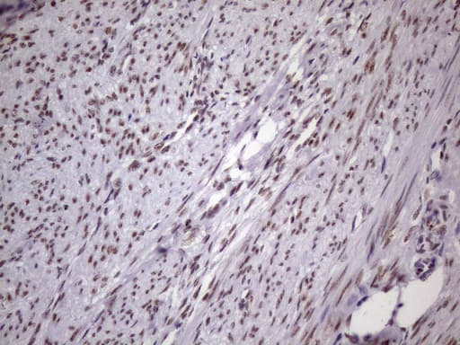 Monoclonal Mouse anti-Human NUDT21 Antibody (clone OTI1B1, Carrier-free, aa2-227, IHC, IF, WB)