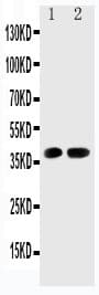 CDK6 Antibody (aa291-310)