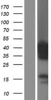 PITPNC1 Protein (Over-Expression Lysate Myc-DDK (Flag))