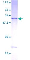 Human DNAJC27 Protein (Recombinant GST)
