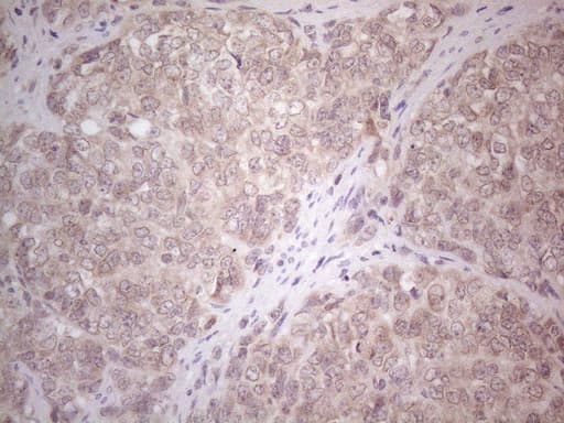 ABCC5 / MRP5 Antibody (clone OTI2C8)