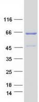 Human WDR20 Protein (Recombinant Myc-DDK (Flag))